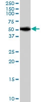 PAB7130 - PICK1