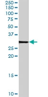 PAB7132 - Syntenin-1 / SDCBP