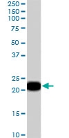 PAB7136 - PEBP1 / RKIP