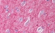 PAB7150 - ICAM5