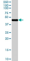 PAB7151 - Zygin-1