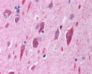 PAB7153 - PIK3CA