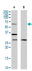 PAB7154 - PRPF31