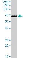 PAB7169 - RAD9A