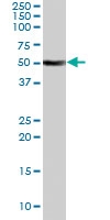 PAB7176 - Fatty acid desaturase 1 (FADS1)