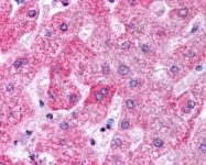 PAB7182 - Apolipoprotein M / Apo M