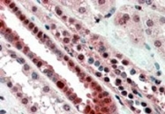 PAB7188 - TCF3 / E2A