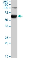 PAB7189 - HNF1 beta / TCF2