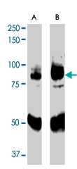 PAB7191 - APPL1 / DIP13A