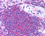 PAB7193 - UBASH3A / STS2