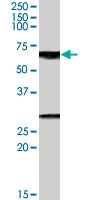 PAB7195 - GPSM2