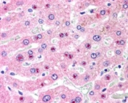 PAB7198 - HDMCP