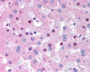 PAB7199 - HDMCP