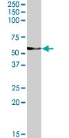 PAB7207 - Vang-like protein 2 (VANGL2)