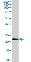 PAB7226 - KLK2 / Kallikrein-2