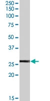 PAB7230 - Glutathione peroxidase 3 / GPX3