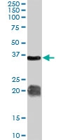 PAB7237 - Arginase-1