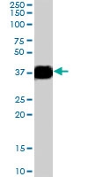 PAB7238 - Arginase-1
