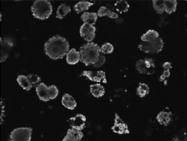PAB7250 - Perilipin-1