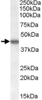 PAB7264 - Casein kinase I epsilon