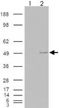 PAB7264 - Casein kinase I epsilon