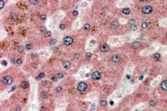 PAB7266 - Apolipoprotein C I / ApoC1