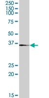 PAB7270 - Tachykinin receptor 1 (TACR1)