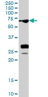PAB7278 - Sal-like protein 4 (SALL4)