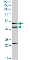 PAB7286 - GABPB1