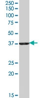 PAB7301 - Renalase