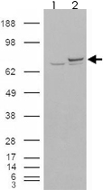 PAB7303 - XRCC6 / Ku70