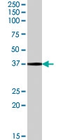 PAB7305 - Interleukin-12 beta / IL12B