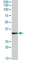 PAB7307 - RPL8