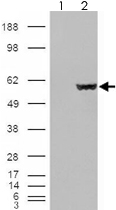 PAB7310 - Fumarase