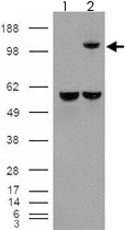 PAB7317 - Insulin-degrading enzyme