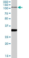 PAB7318 - Insulin-degrading enzyme