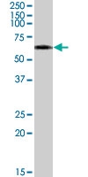 PAB7358 - Vitamin D-binding protein