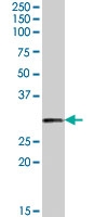 PAB7360 - Tumor protein D54 (TPD52L2)