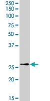 PAB7361 - Tumor protein D53 (TPD52L1)