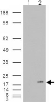 PAB7364 - PLA2G1B