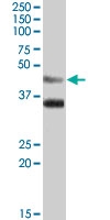PAB7369 - Arylsulfatase B