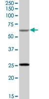 PAB7393 - COL4A3BP