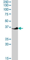 PAB7399 - LASP1