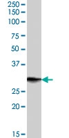 PAB7402 - PRRX1