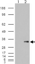 PAB7404 - WISP1