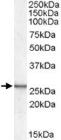 PAB7406 - CSRP2