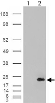 PAB7406 - CSRP2