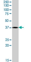 PAB7411 - Proenkephalin-A (PENK)