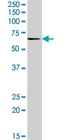 PAB7414 - Activin receptor type 1 / ACRV1