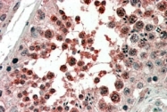 PAB7414 - Activin receptor type 1 / ACRV1